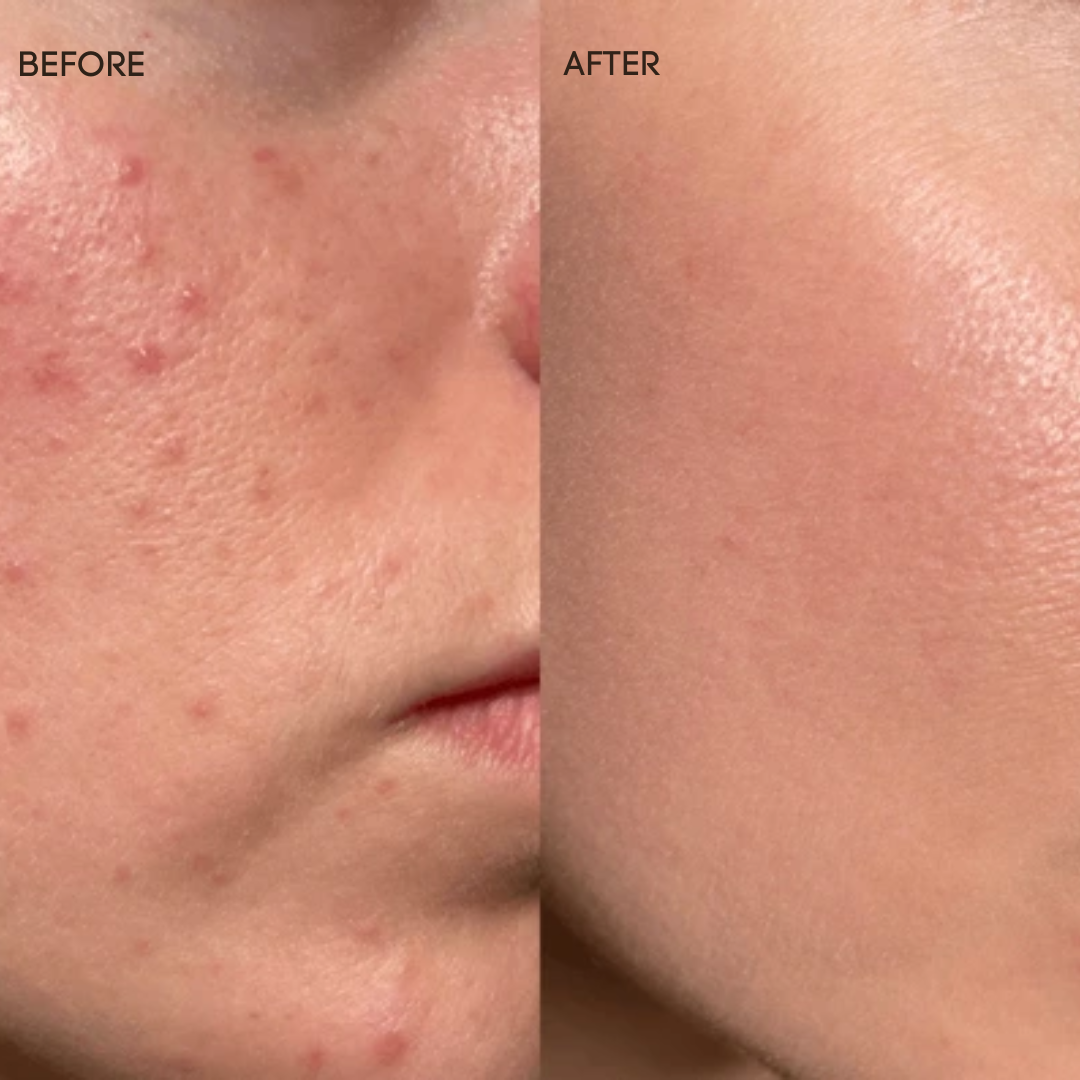 Pastel Jade Calm Your Skin Brightening Powder Mask | Redness Relief, Acne Soothing & Oil Control
