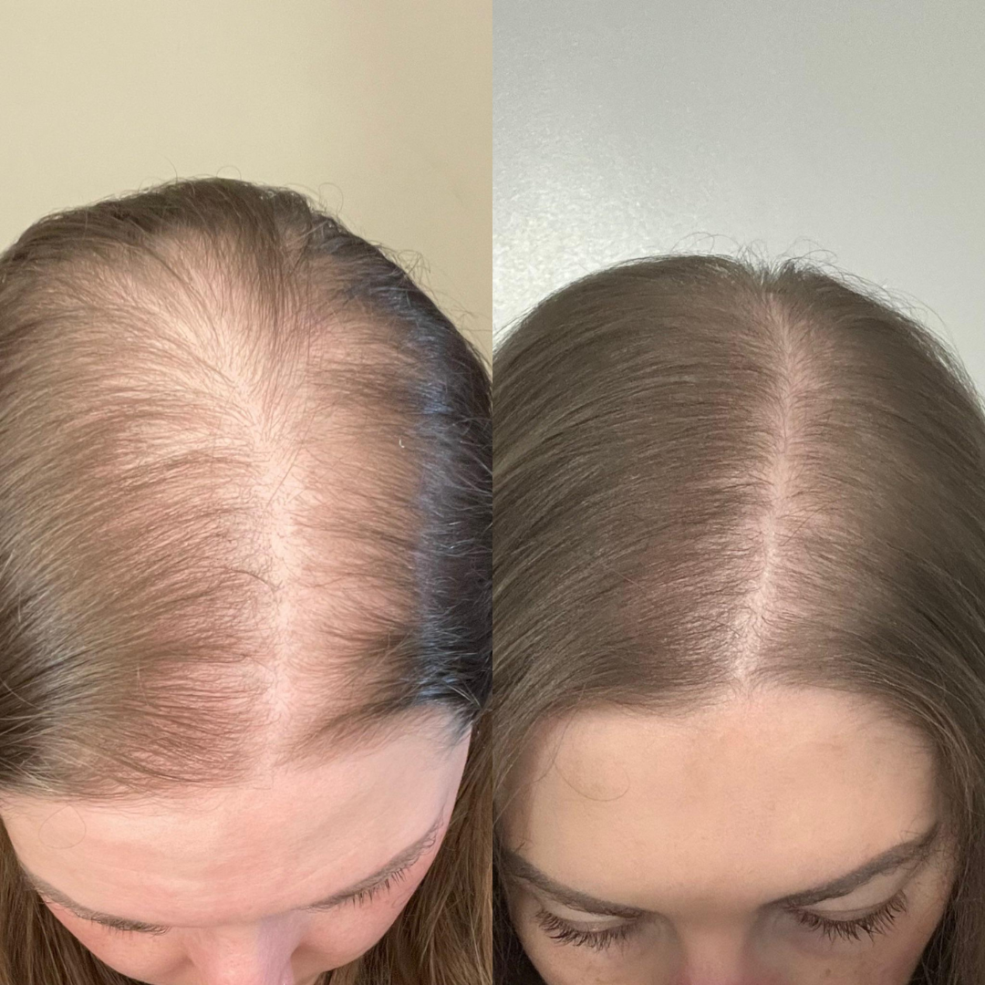 Hair Pantry Smooth & Long Hair Deal - Hair growth serum + Frizz Tamer Serum - Stronger roots , heat protector , split end control & Straight hair - Also reduce hair fall & Boosts Growth