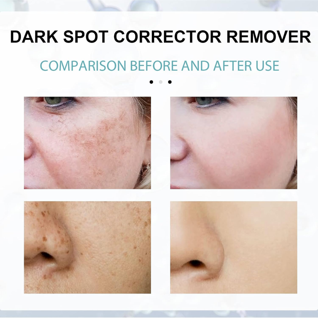 Celimax Whitening Cream - Reduce Dark Spots & Pigmentation | Minimize Open Pores