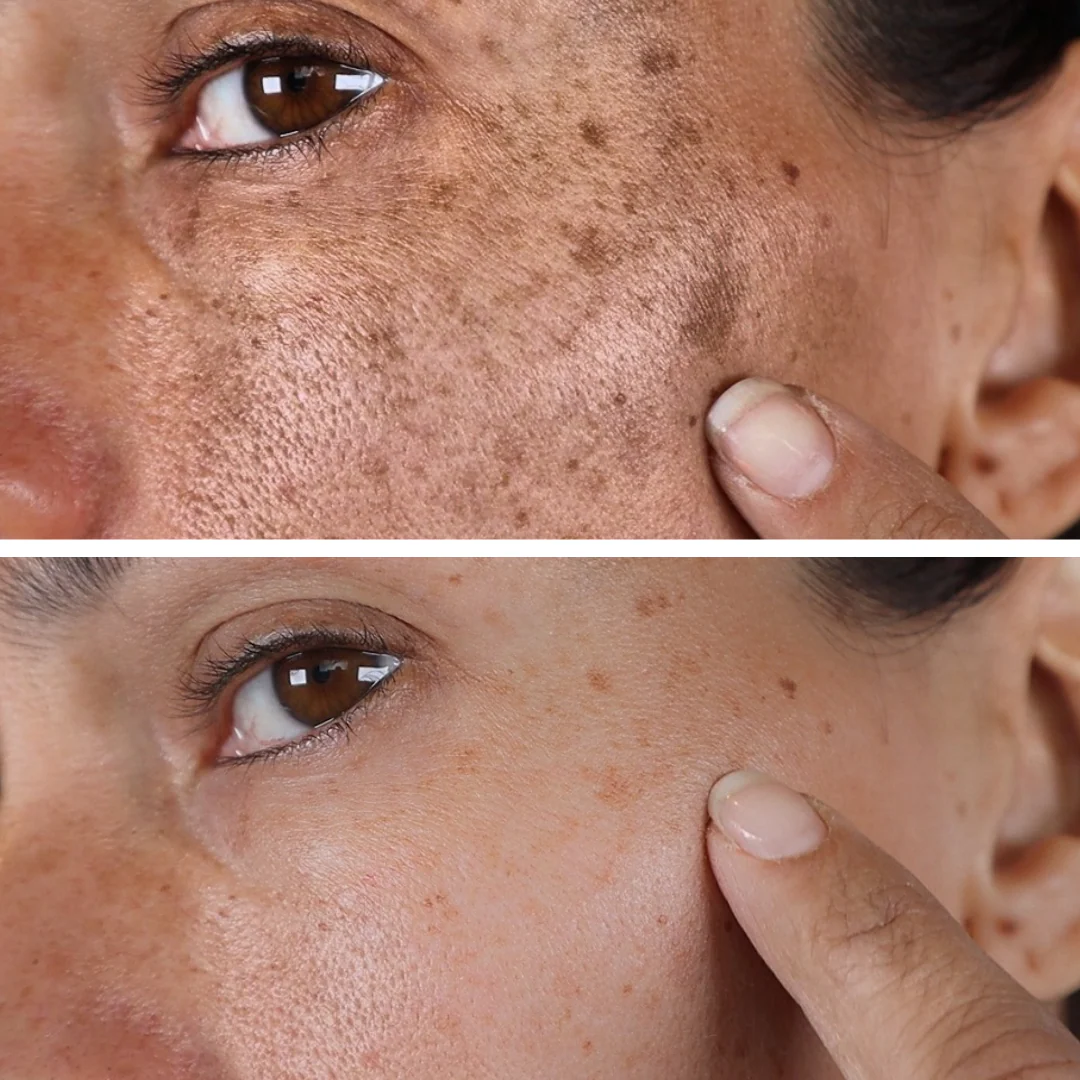 Celimax Whitening Cream - Reduce Dark Spots & Pigmentation | Minimize Open Pores