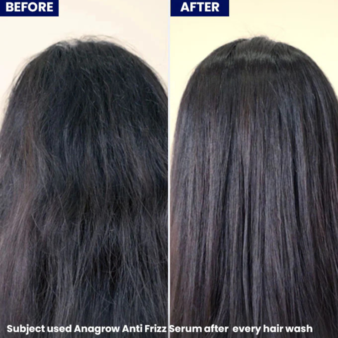 Hair Pantry Smooth & Long Hair Deal - Hair growth serum + Frizz Tamer Serum - Stronger roots , heat protector , split end control & Straight hair - Also reduce hair fall & Boosts Growth