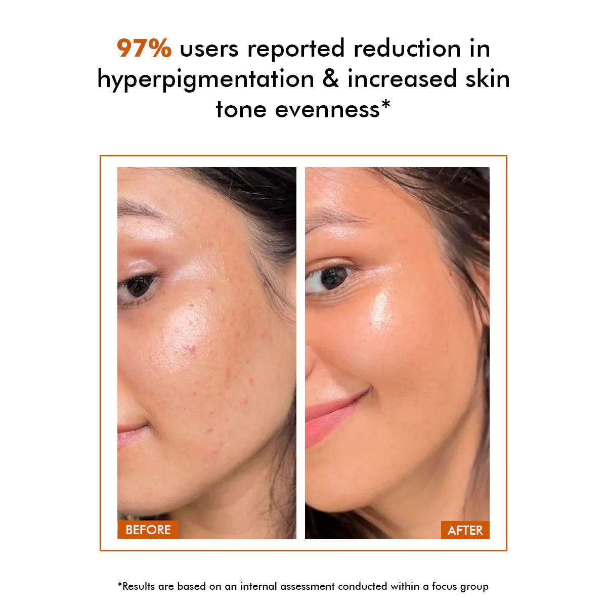 Xpose Full Coverage Foundation & Muse C Brightening Vitamin C Serum | Complete Skin-Perfecting Duo for Flawless, Radiant Skin