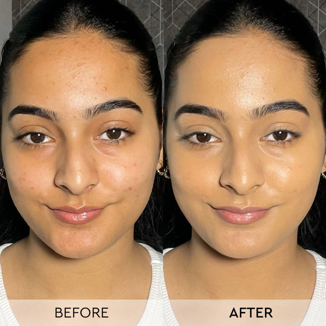 Makeup Revolution Ultimate Glow Bundle: Skin Silk Serum Foundation & Multi Glow Balm | Hydrating & Radiant Skin Duo