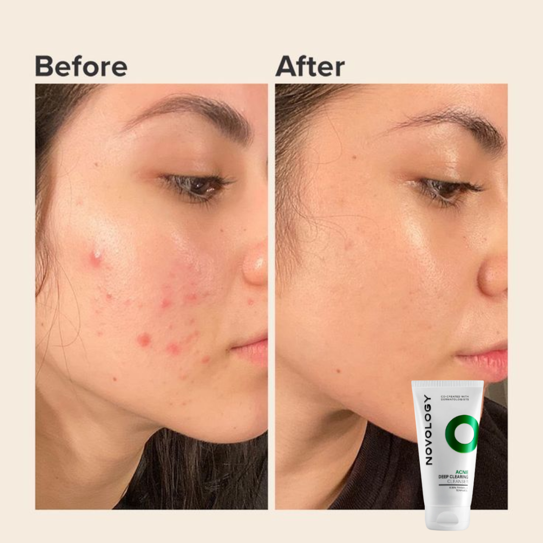 Novology clearing cleanser
