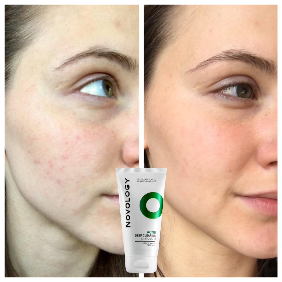 Novology clearing cleanser