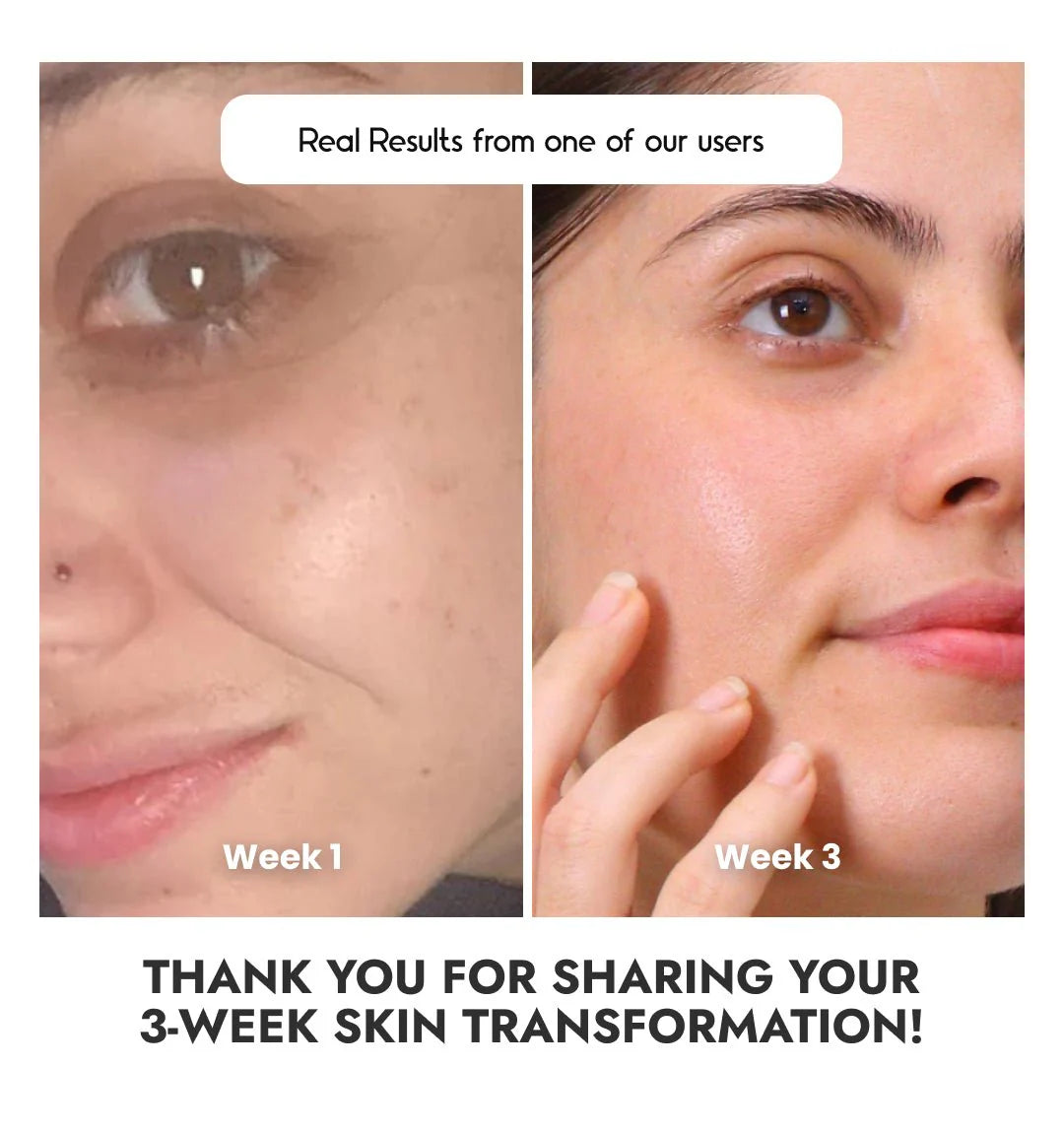Xpose Full Coverage Foundation & Muse C Brightening Vitamin C Serum | Complete Skin-Perfecting Duo for Flawless, Radiant Skin